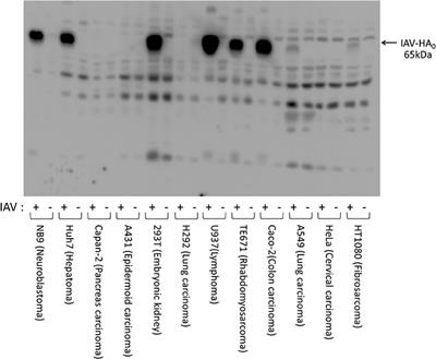 <mark class="highlighted">Enterokinase</mark> Enhances Influenza A Virus Infection by Activating Trypsinogen in Human Cell Lines